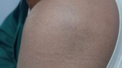 Konfrontir Ulang Tak Berujung: Publik Pertanyakan Transparansi Penyidikan Polres Probolinggo Dalam Kasus Suarni