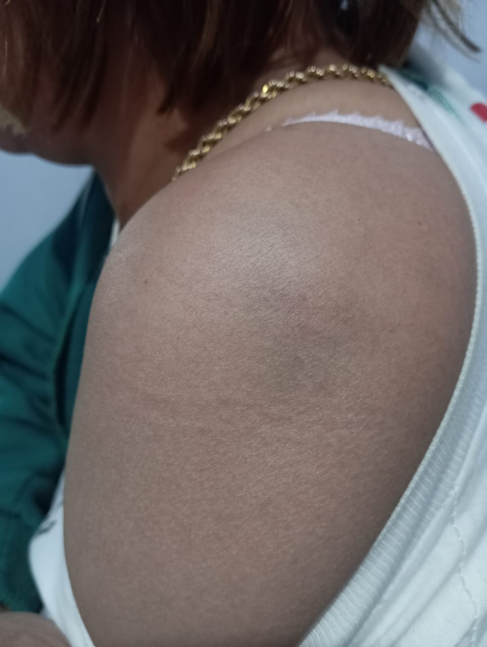 Konfrontir Ulang Tak Berujung: Publik Pertanyakan Transparansi Penyidikan Polres Probolinggo Dalam Kasus Suarni