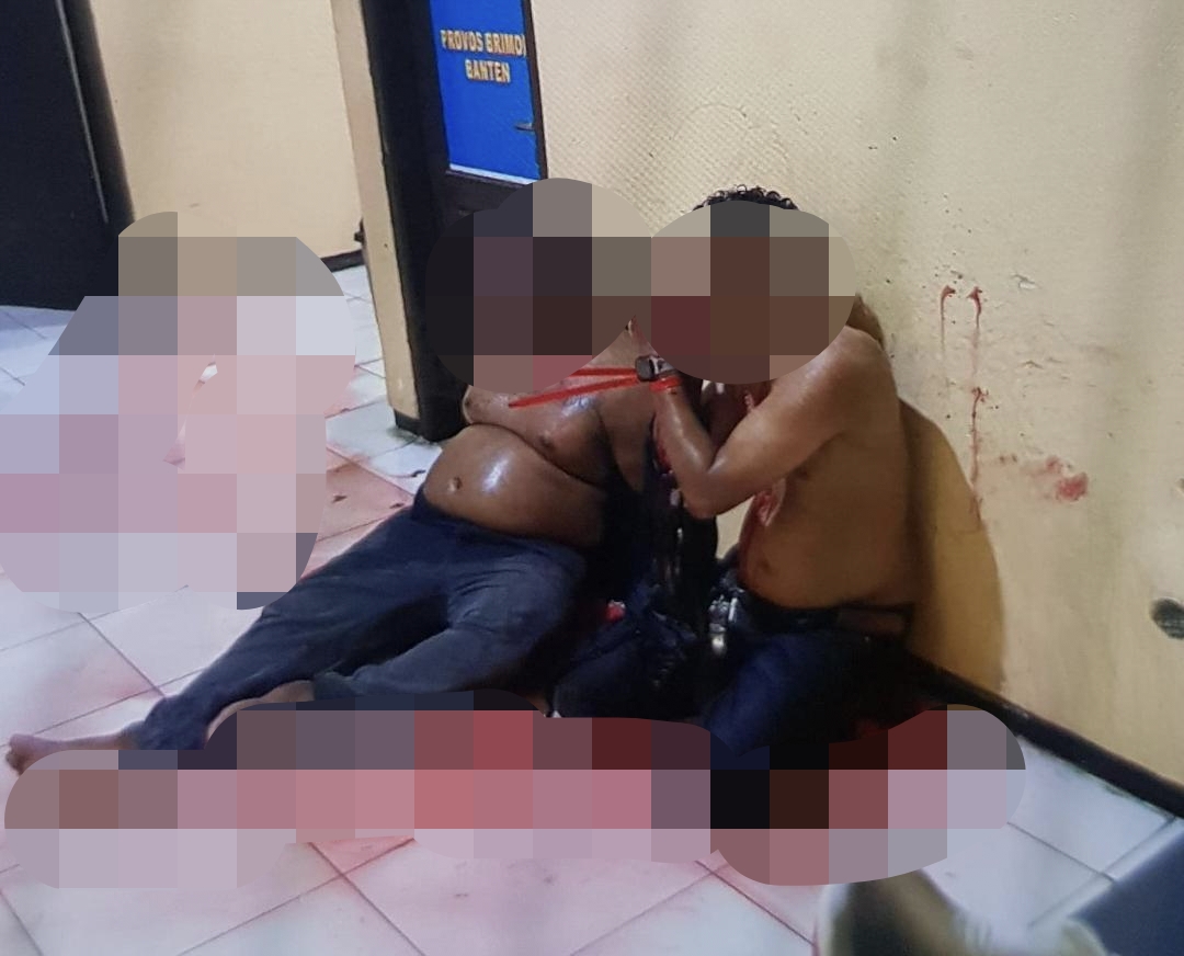 Aksi Debt Collector Berujung Pembacokan, Anggota Brimob Polda Banten Alami Luka Serius di Kepala dan Tangan