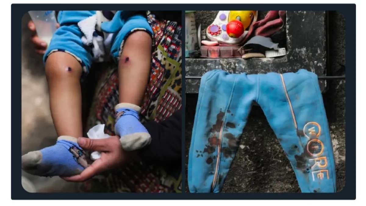 Dampak Perang Terhadap Anak-anak di Gaza